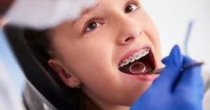 Braces are not solely a cosmetic solution. While aesthetics often motivate patients,