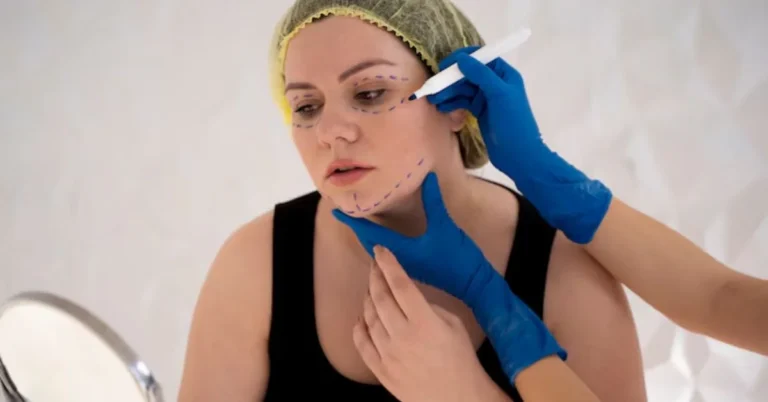 Lower blepharoplasty is a surgical intervention focused on the lower eyelid area.